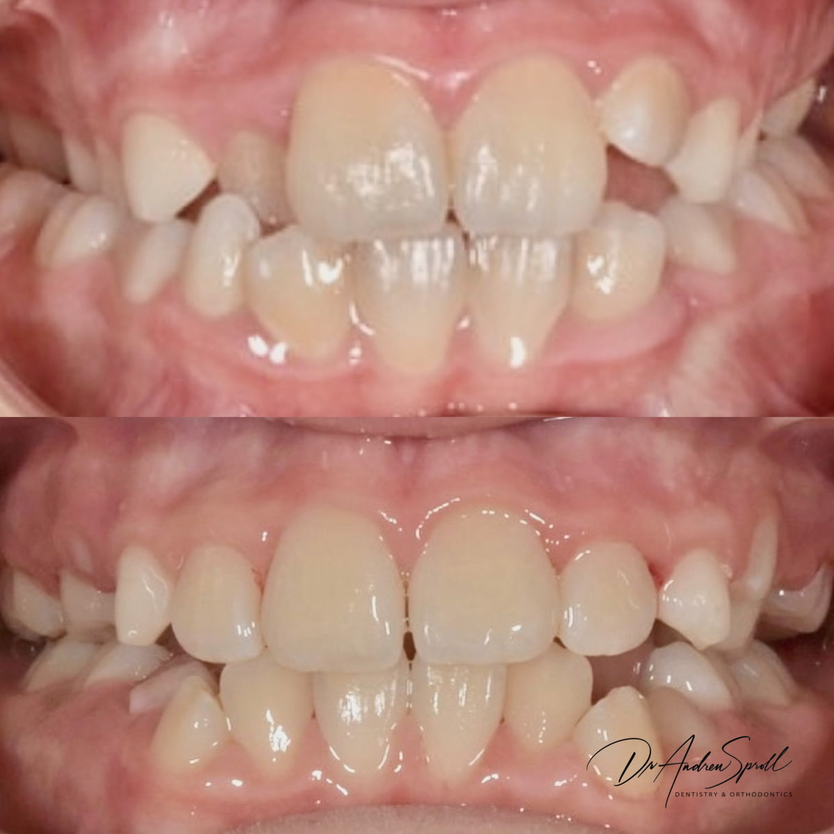 Dr Andrew Sproll patient before and after